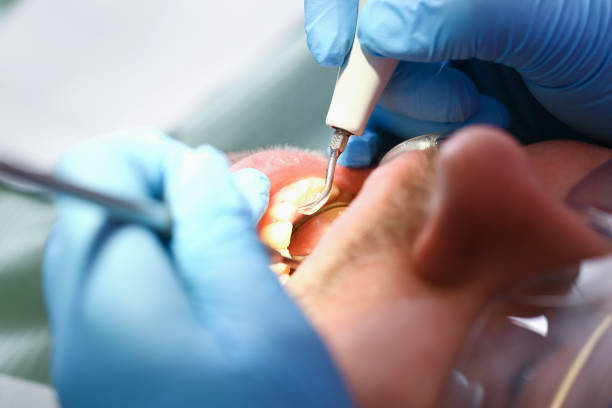 Best Emergency Cosmetic Dentistry (e.g., broken veneers) in Oceano, CA